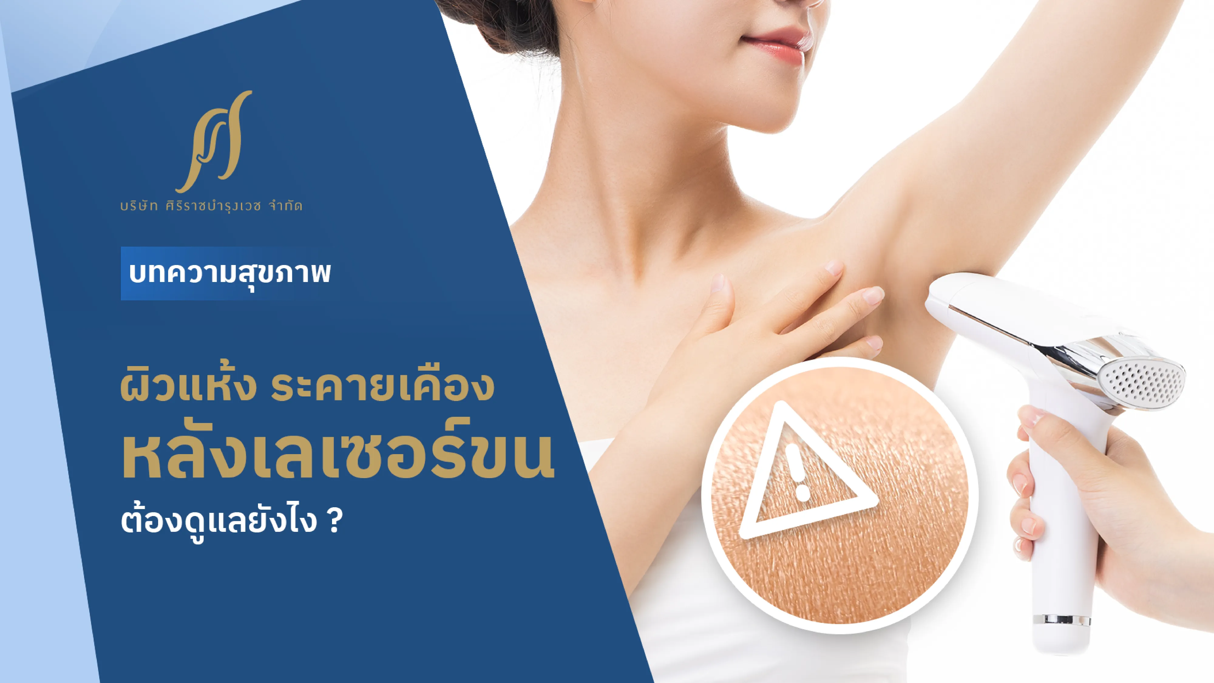 ผู้หญิงกำลังเลเซอร์ขนรักแร้ ด้วยเครื่องยิงเลเซอร์ พร้อมข้อความที่ระบุว่า “ผิวแห้ง ระคายเคือง หลังเลเซอร์ขน ต้องดูแลยังไง ?”