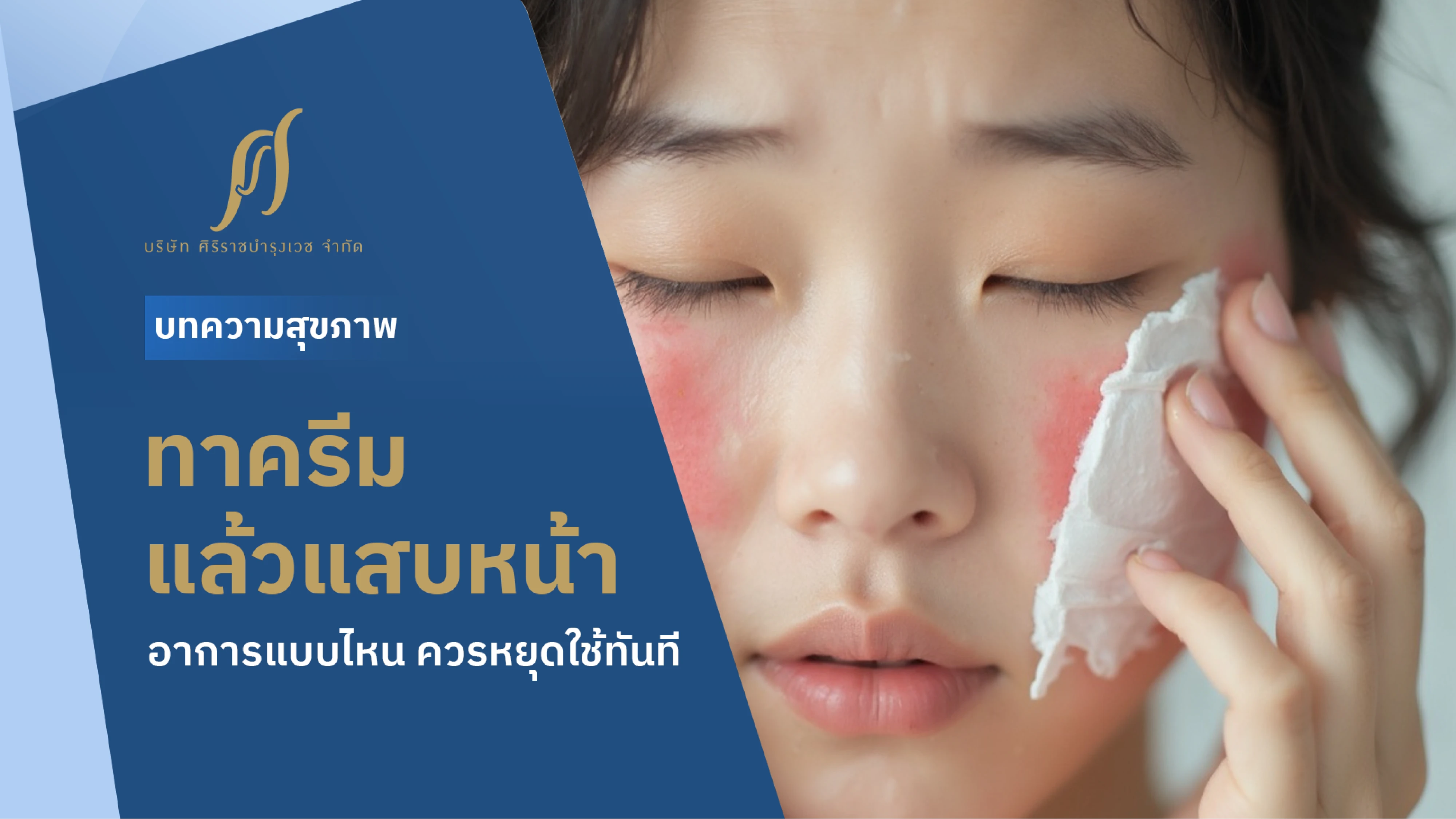 ผู้หญิงผิวหน้าอักเสบและกำลังทาครีมอยู่บนหน้า ด้านซ้ายมี Text “ทาครีมแล้วแสบหน้า อาการแบบไหน ควรหยุดใช้ทันที”