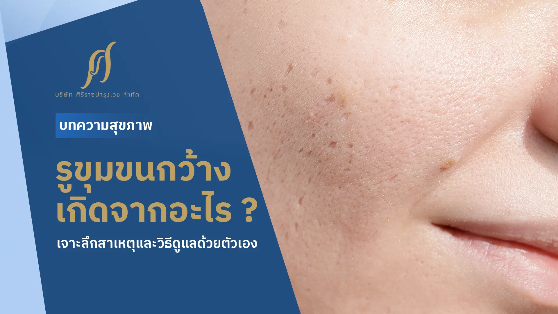 ผิวหน้าที่มีรูขุมขนกว้าง พร้อมข้อความที่ระบุว่า “รูขุมขนกว้างเกิดจากอะไร เจาะลึกสาเหตุและวิธีดูแลตัวเอง