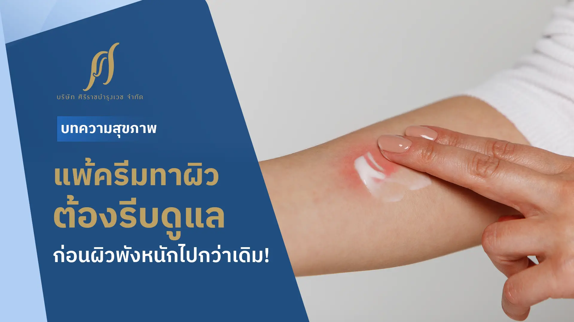 ลักษณะของอาการแพ้ครีมทาผิว พร้อมข้อความที่ระบุว่า “แพ้ครีมทาผิวต้องรับดูแล ก่อนผิวพังหนักไปกว่าเดิม”