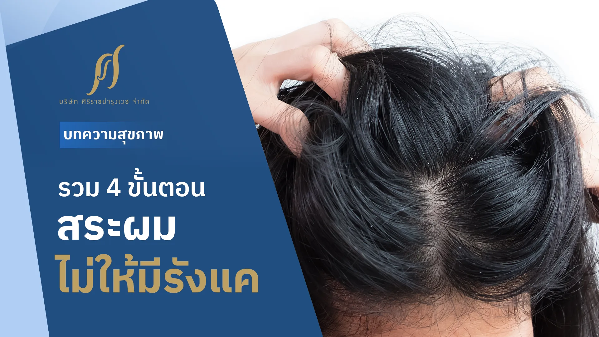 หนังศีรษะที่มีรังแค พร้อมข้อความที่ระบุว่า “รวม 4 ขั้นตอน สระผมไม่ให้มีรังแค”